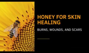 Honey for Skin Healing